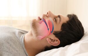 Homem dormindo de boca aberta